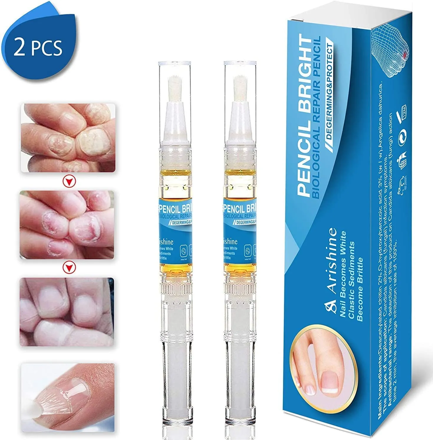 Arishine Fungus Treatment, Fungus Stop, Anti Fungus Nail Treatment, Effective Against Nail Fungus, Anti Fungal Nail Solution, Toenails and Fingernails Solution (2 Pack)